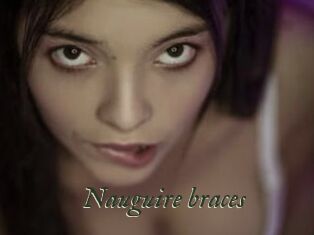 Nauguire_braces